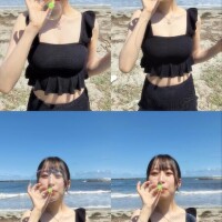 日焼けが痒すぎる??