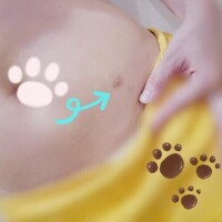 【雑談】手術とタトゥーの話(入ってません)?