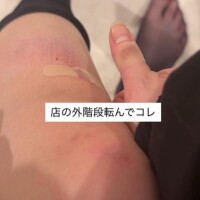 膝の傷、痛いのに…変なとこ疼いちゃうよぉ?