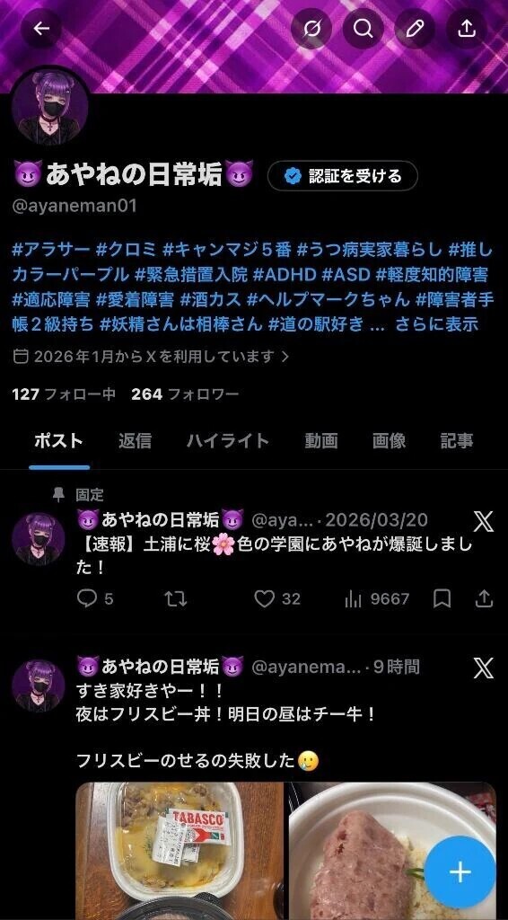 X覗きに来てちょ♡