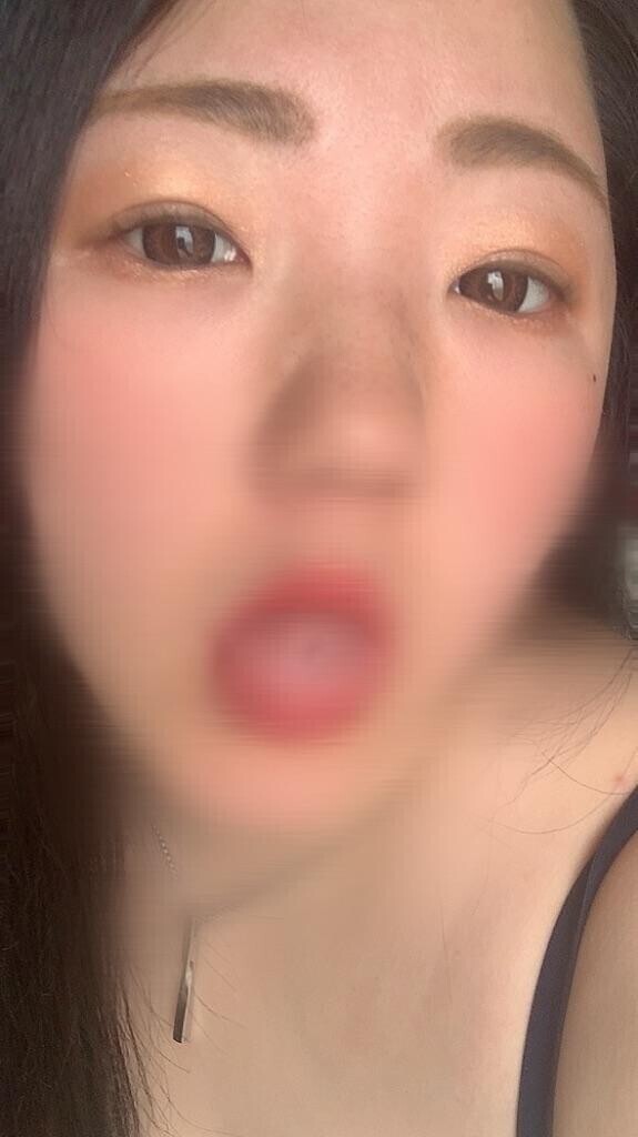 花粉症?