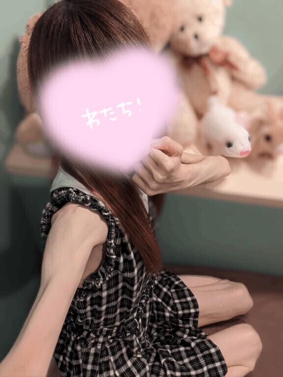急遽