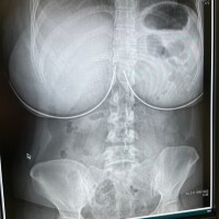 医学かエロ画像か、君はどう生きる？