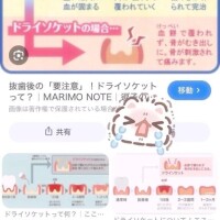 歯の恐怖❣️🦷