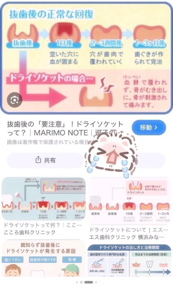 歯の恐怖❣️🦷