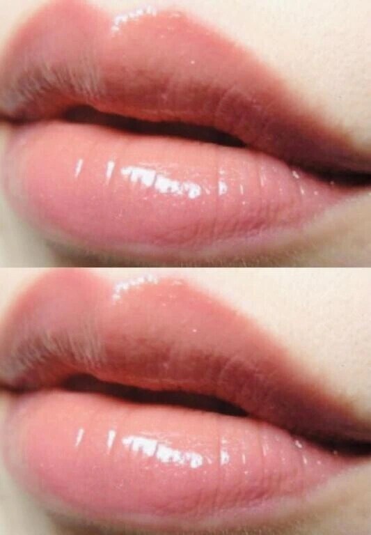 明日は満了の為、受付終了しています