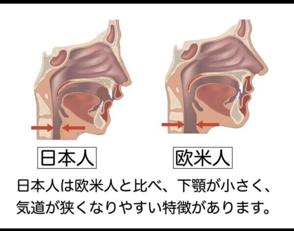 聞いておくれ🫨🫨
