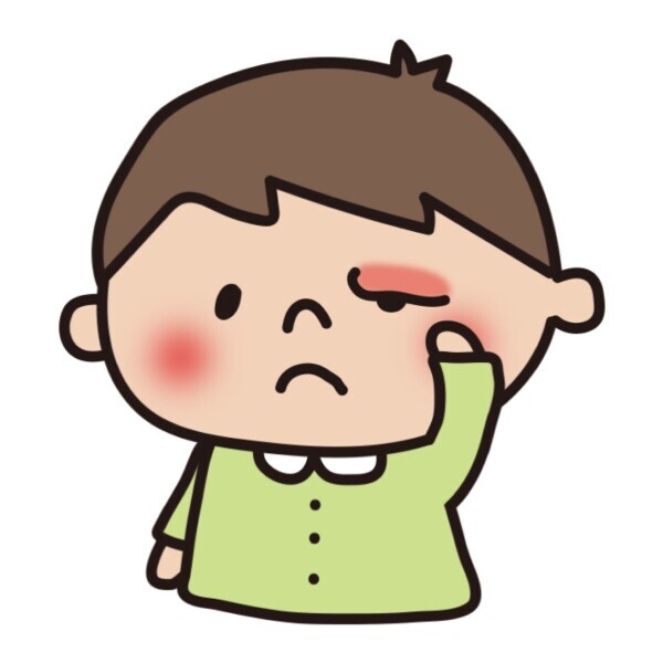 めぇ腫れたー😭