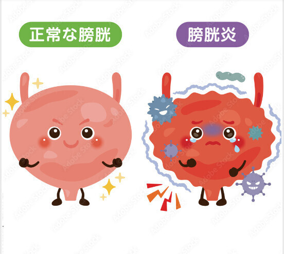 🤎誰でもなっちゃう