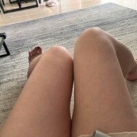 かすみ