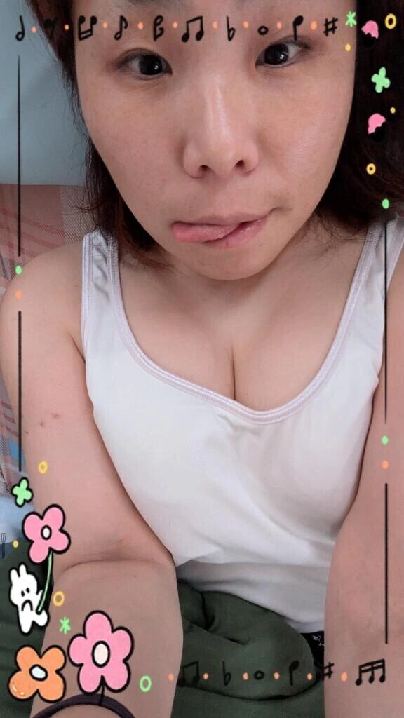 気圧痛