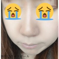 やっちまった🤣