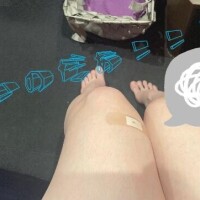 痛いの??