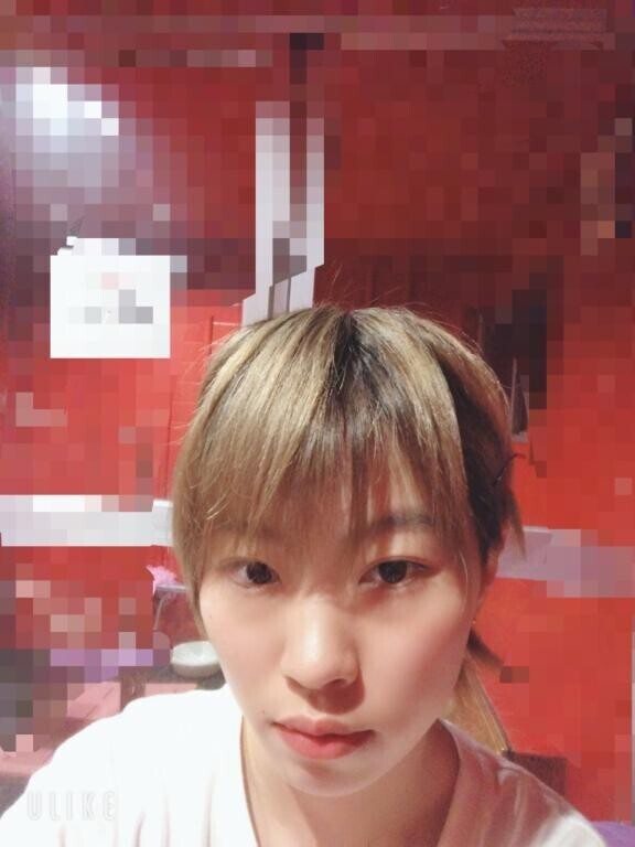 前髪問題