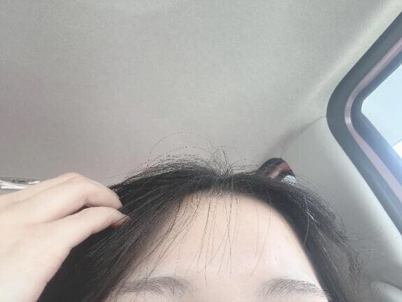 ギャグ漫画のような衝突