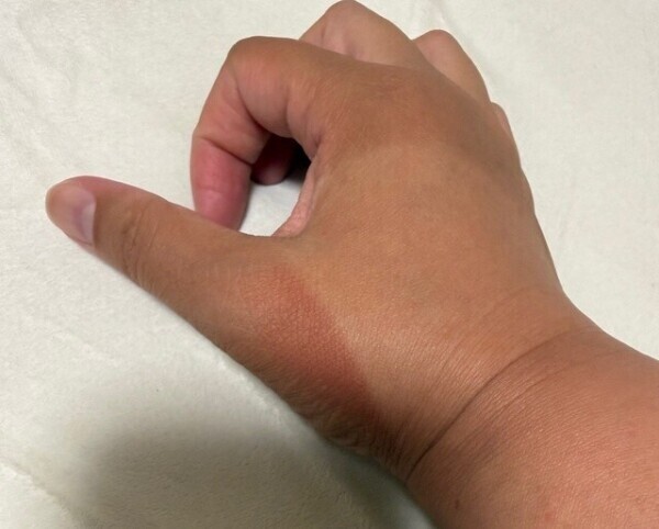本調子じゃないのに･･･