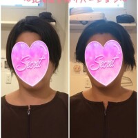 【全身美容鍼フルコース～北海道里帰り編～】