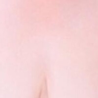 あこ