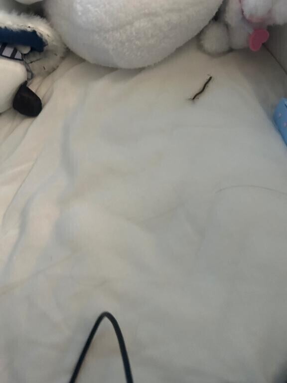 ムカデに刺されて起きました?