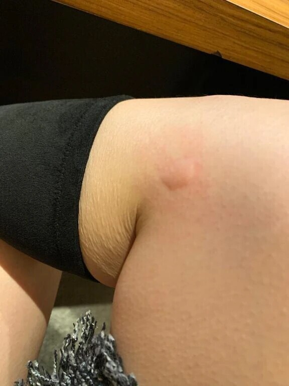 まだ居るあいつ🦟