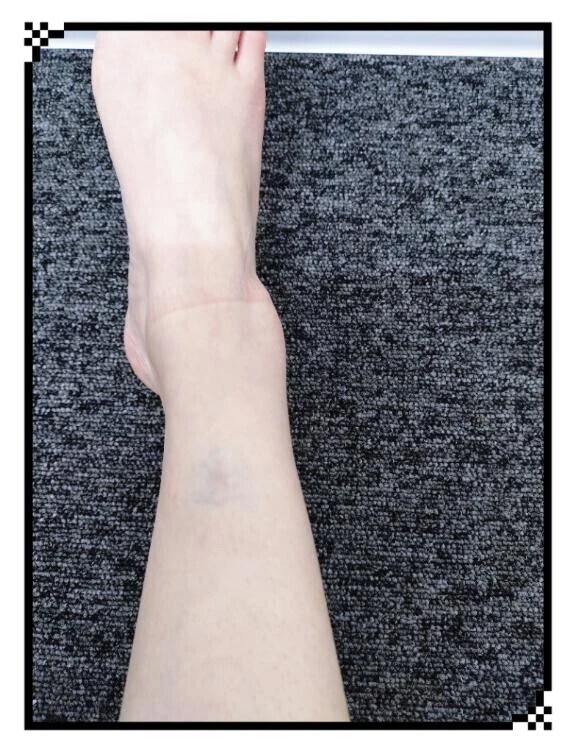 ドジっ子は治らない🥺