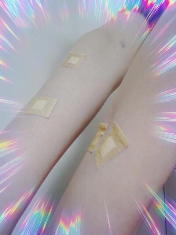 腕が穴だらけ＼(^o^)／