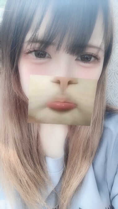 います