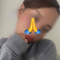アリー