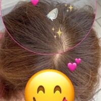 超ツイテル??