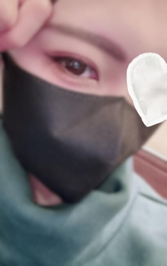 でこ