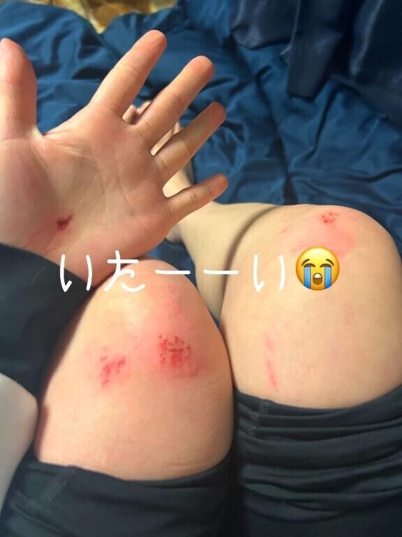 流れ星の後の大事故🤕