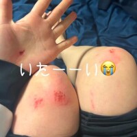 あん