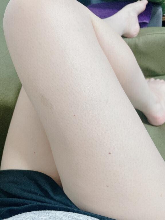 昨日は