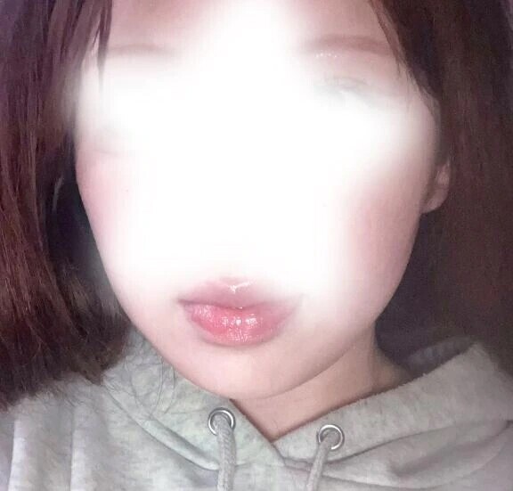 デコ出し