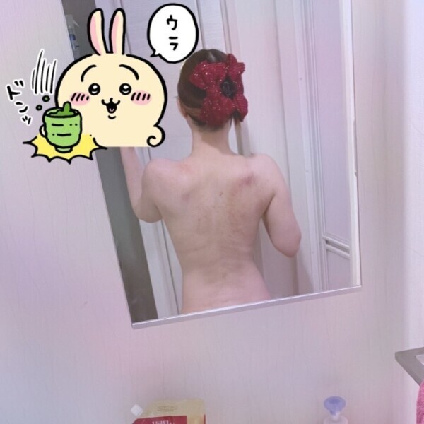 美と痛みは紙一重やな