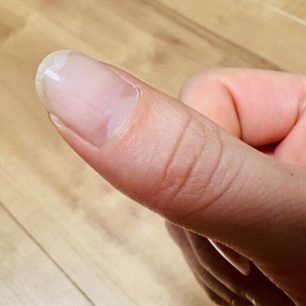 負傷…