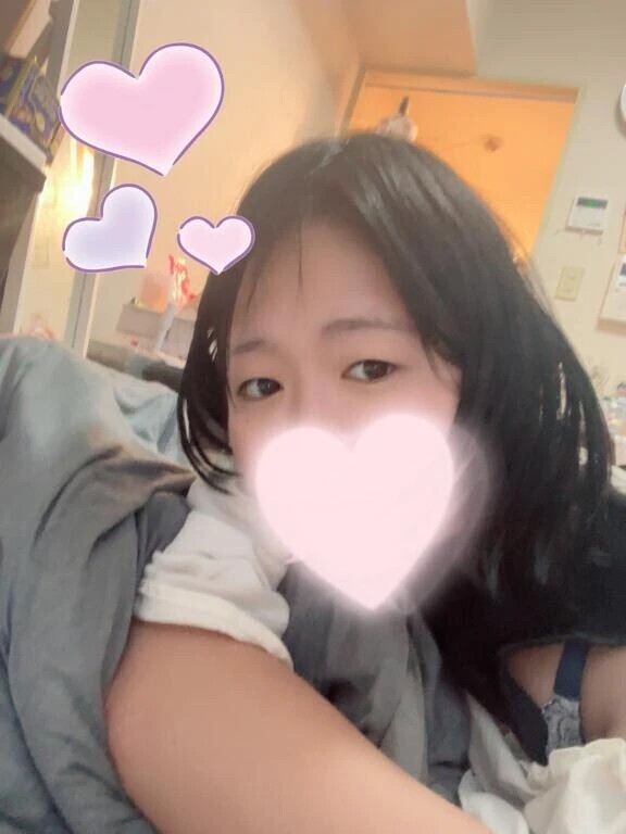 急遽