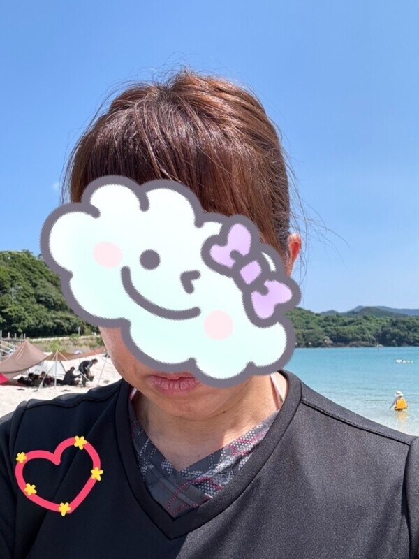 日焼け