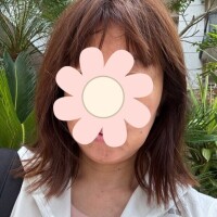 今年の日焼け