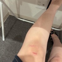 あずき