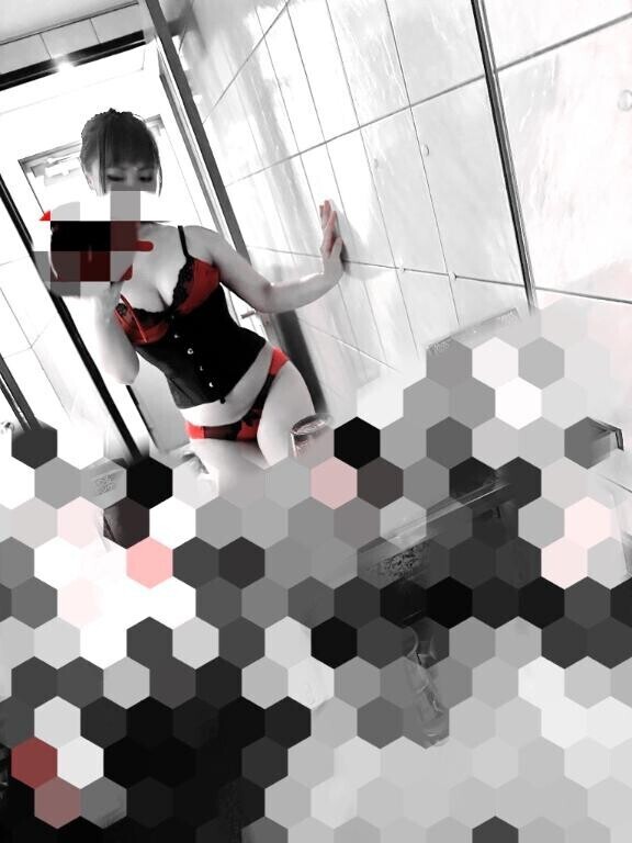①痛くないアナ〇