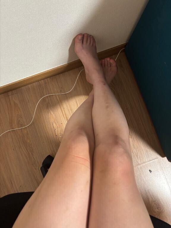 キック??キック??キック??