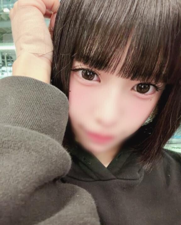 手怪我してしまた?
