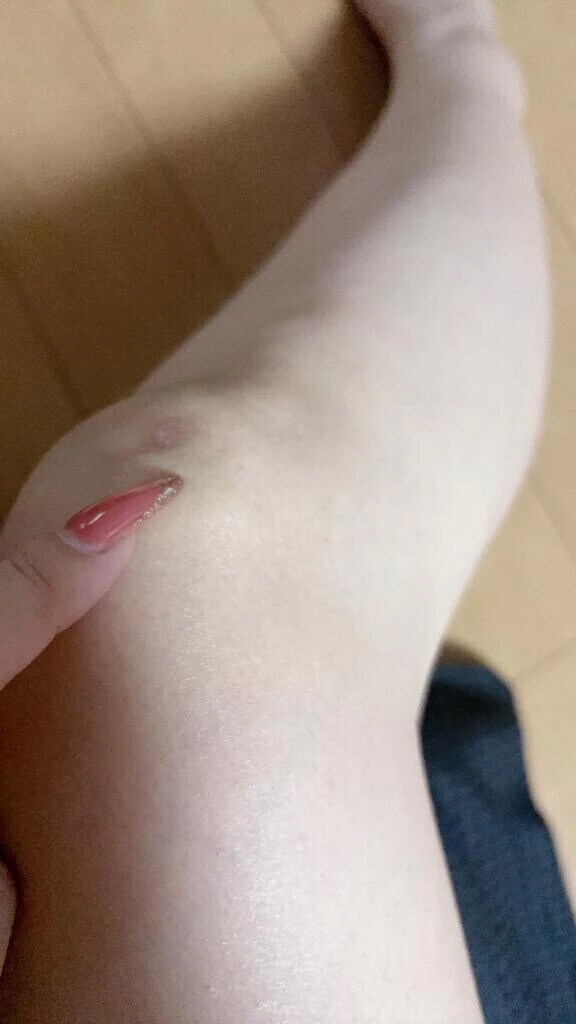傷完治🩹