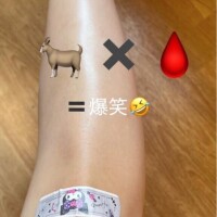 ヤギにやられたwwww