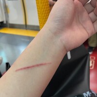 怪我した（ ;  ; ）