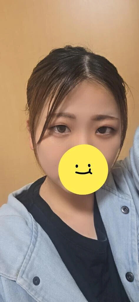 右目が…！！