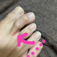 え"？！:(；ﾞﾟ'ωﾟ'):この謎の点々何なの？！