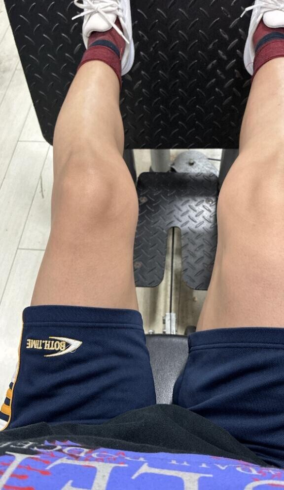 痛いからとて(*´-`)動かさねば