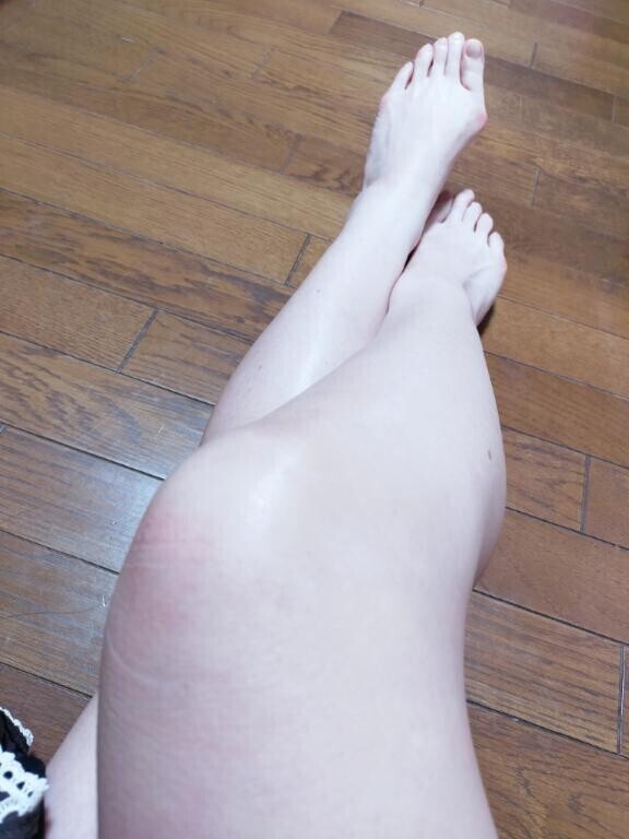 タイツが原因ではないね